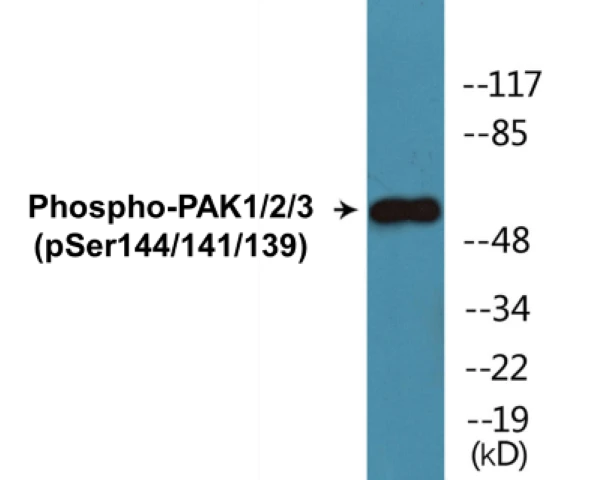 PAK1 + 2 + 3 (phospho Ser144 + Ser141 + Ser139) Cell Based ELISA Kit (A102457-296)