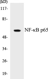 NF-kB p65 Cell Based ELISA Kit (A103384-96)