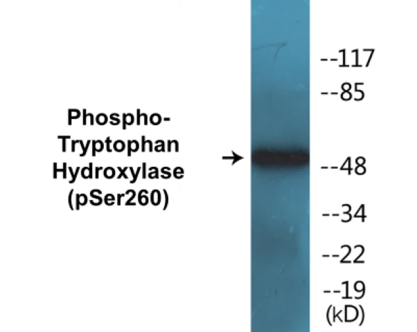 Tryptophan Hydroxylase (phospho Ser260) Cell Based ELISA Kit (A102230-296)