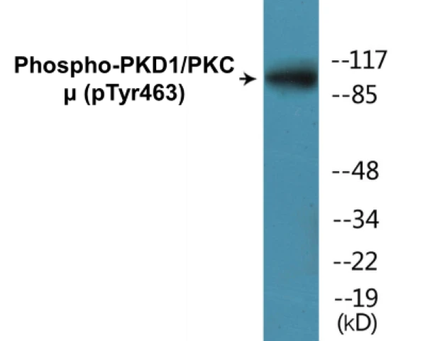 PKD1 (phospho Tyr463) Cell Based ELISA Kit (A102307-296)