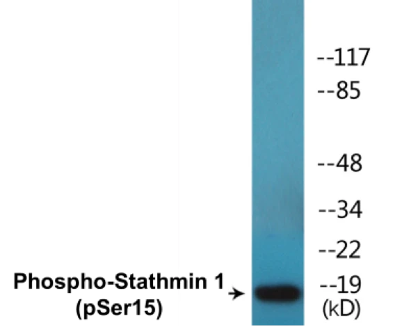 Stathmin 1 (phospho Ser15) Cell Based ELISA Kit (A102562-296)