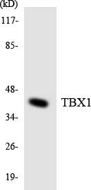 TBX1 Cell Based ELISA Kit (A103730-96)