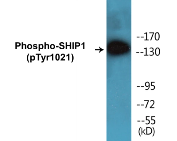 SHIP1 (phospho Tyr1021) Cell Based ELISA Kit (A102098-296)