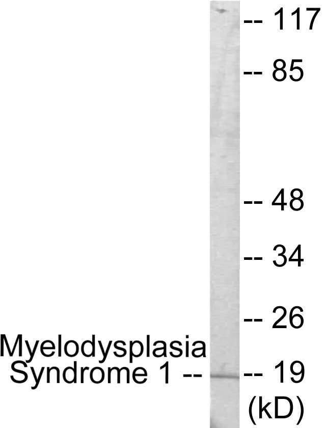 Myelodysplasia Syndrome 1 Cell Based ELISA Kit (A103614-96)