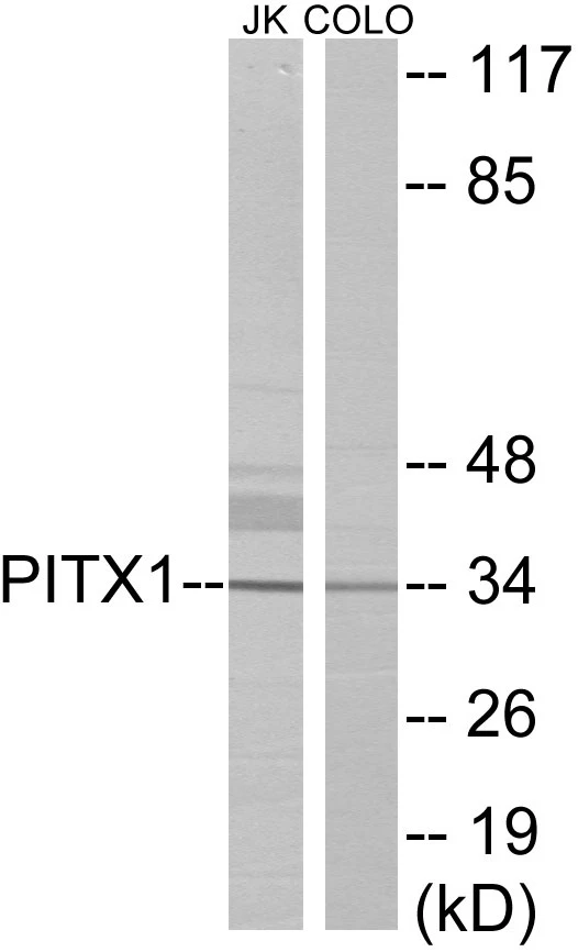 PITX1 Cell Based ELISA Kit (A103155-96)