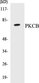 PKCB Cell Based ELISA Kit (A103202-96)