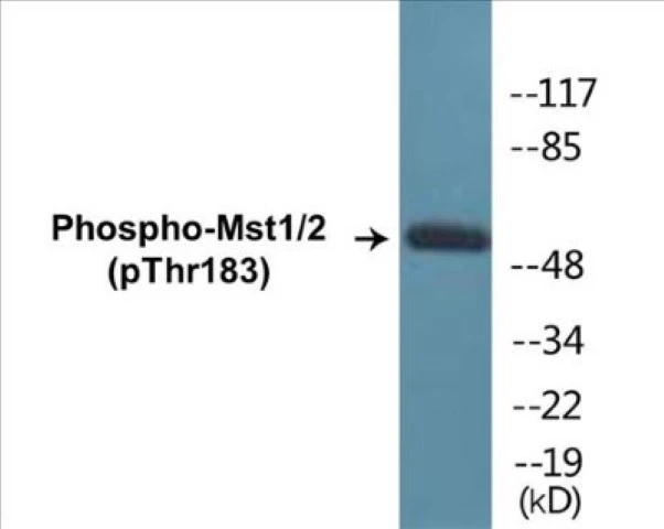 Mst1 + 2 (phospho Thr183) Cell Based ELISA Kit (A102690-296)