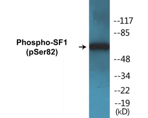 SF1 (phospho Ser82) Cell Based ELISA Kit (A102678-296)