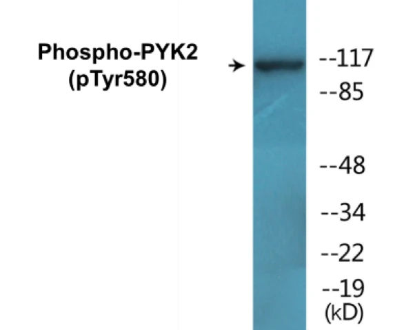 PYK2 (phospho Tyr580) Cell Based ELISA Kit (A102288-296)